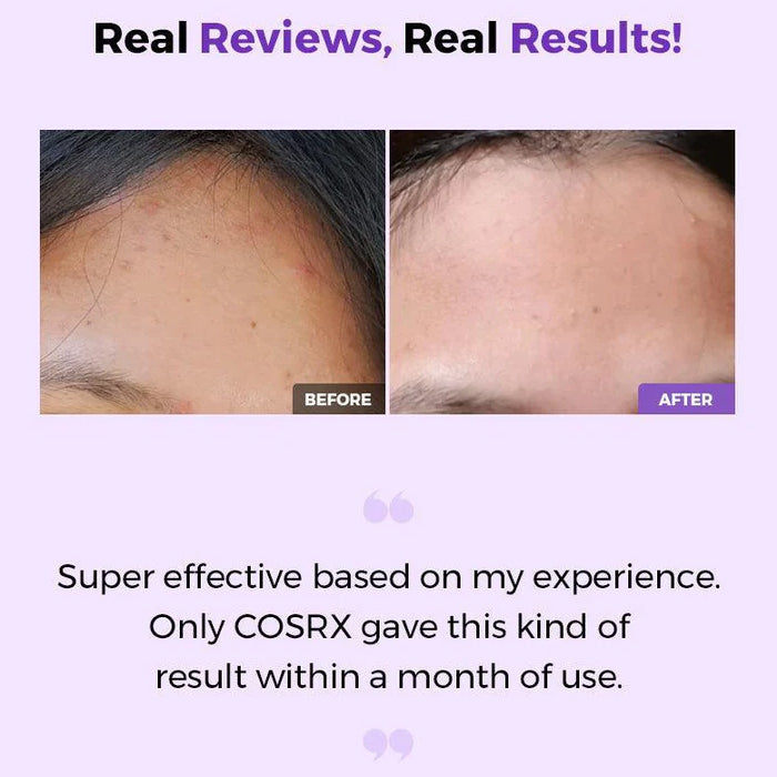 [COSRX] AHA/BHA Clarifying Treatment Toner