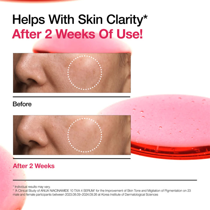 [ANUA] NIACINAMIDE 10%+TXA 4% Serum