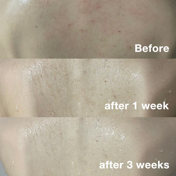 [MEDICUBE] Red Body Wash