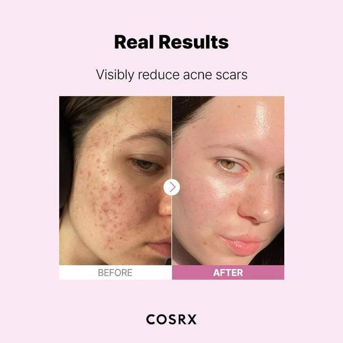 [COSRX] The Niacinamide 15 Serum