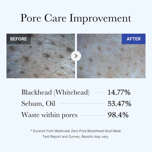 [MEDICUBE] Zero Pore Blackhead Mud Mask